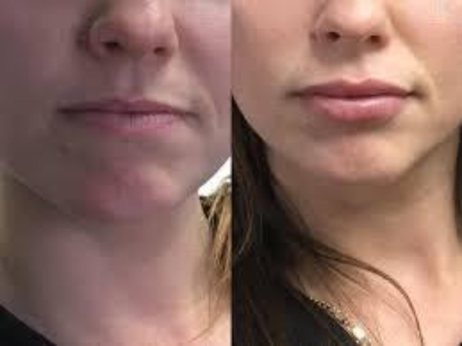 Angel Lift Before and After Real Customer Transformations and Reviews